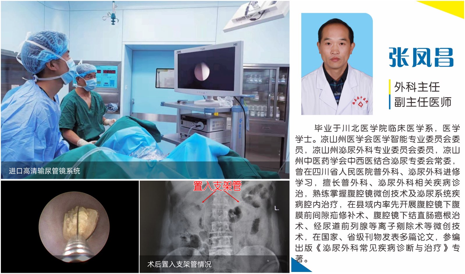 德昌县中医医院肾结石治疗方案